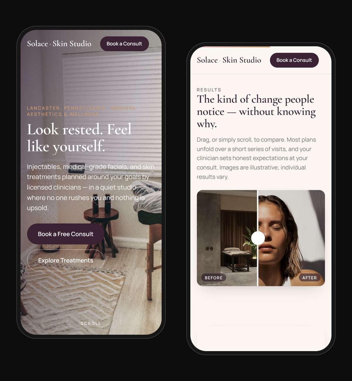 Solace Skin Studio concept site on a phone